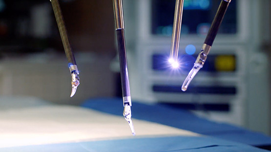 image of a robotic surgery