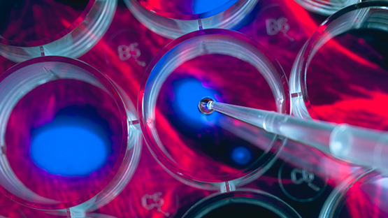 image of a cancer screening lab test