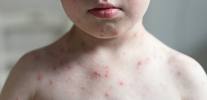 image of a woman receiving dermatology treatment