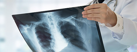 image of a doctor looking at a chest xray