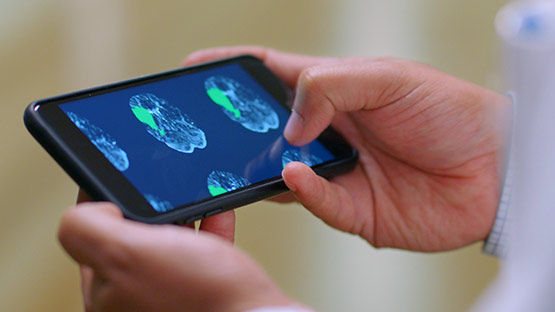 Image of innovative rapid CT scan technology